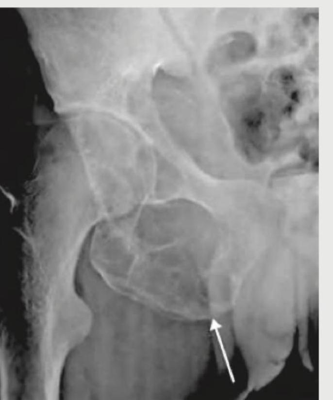 Image for question 276