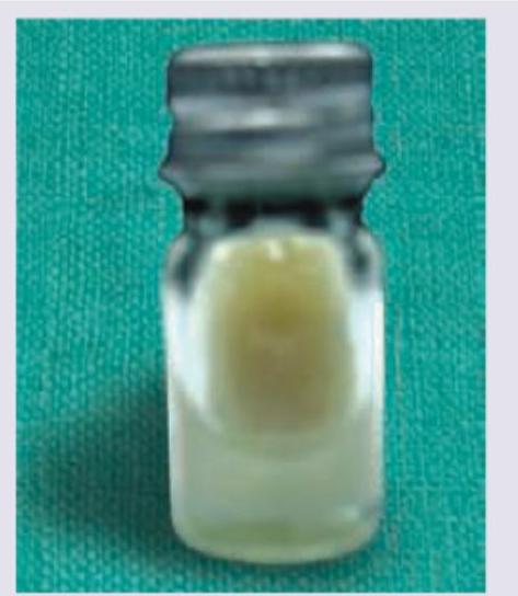 Image for question 168