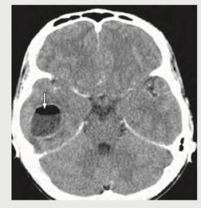 Image for question 353