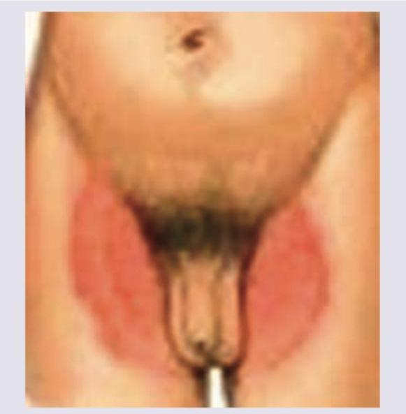 Image for question 180