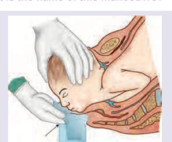 Image for question 836