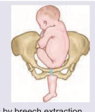 Image for question 837