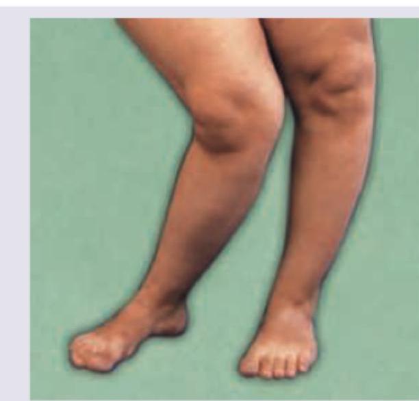 Image for question 653