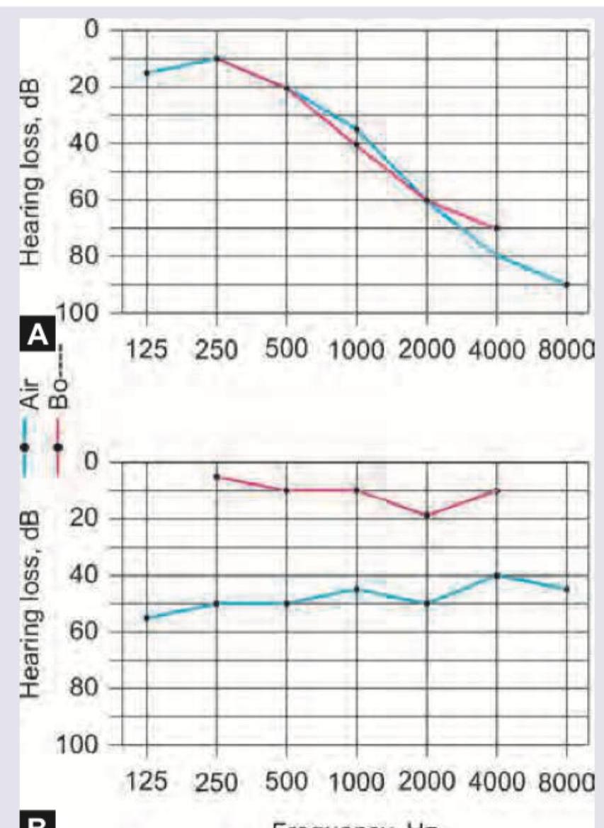 Image for question 114