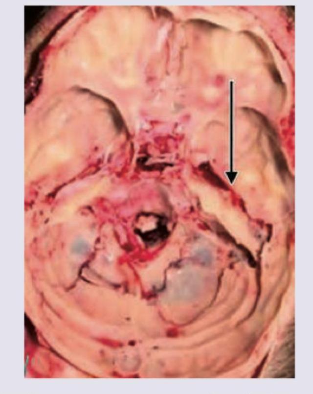 Image for question 5