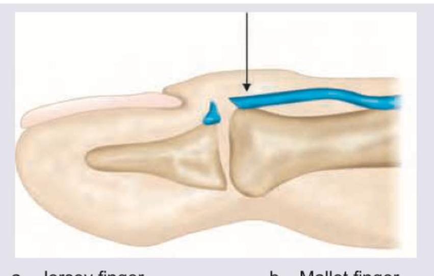 Image for question 9