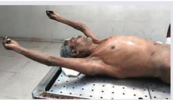 Image for question 237