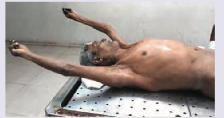 Image for question 128