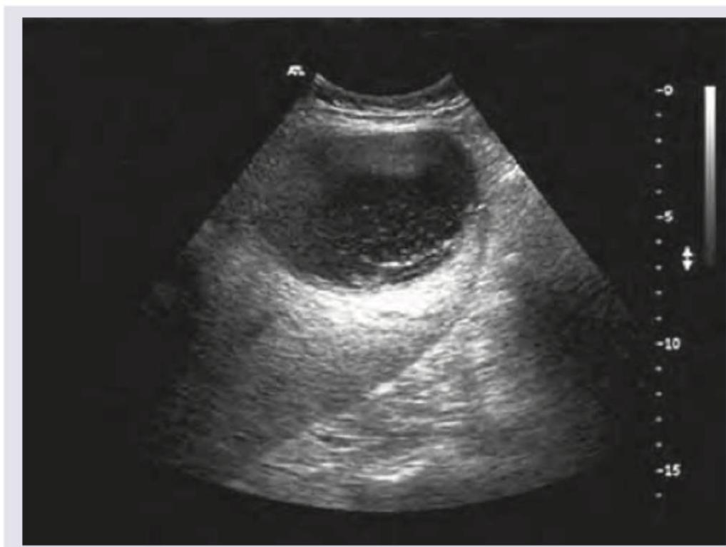 Image for question 733