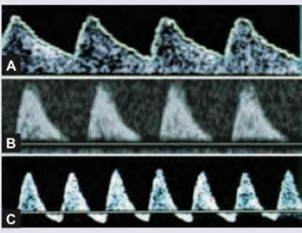 Image for question 945