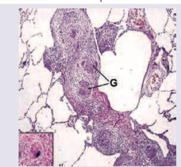 Image for question 415