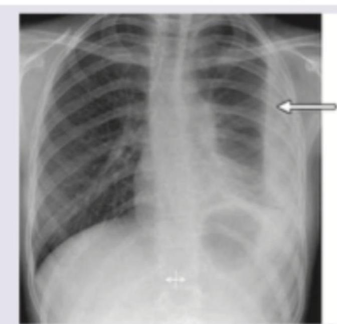 Image for question 236