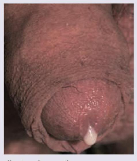 Image for question 95