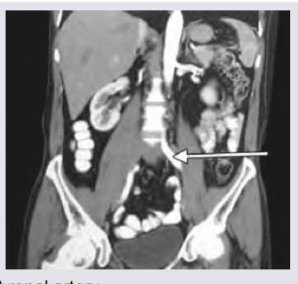 Image for question 107