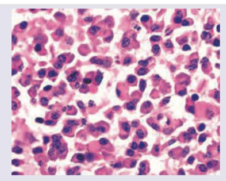 Image for question 1318