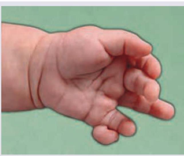 Image for question 657