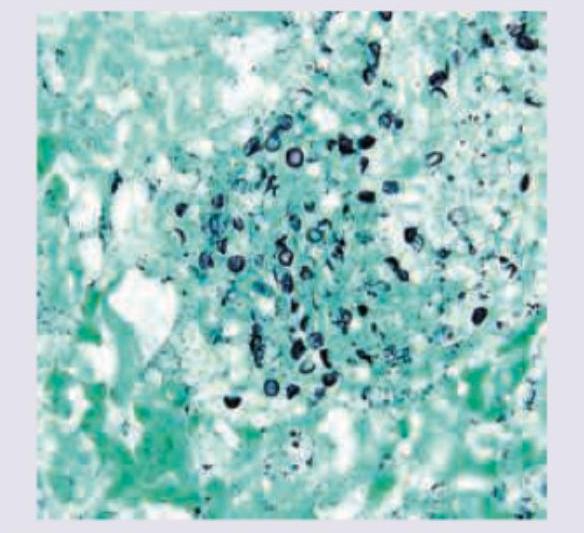 Image for question 119