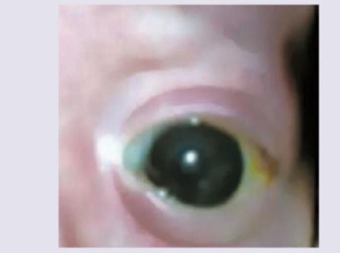 Image for question 333