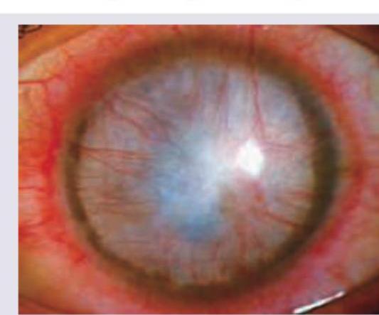 Image for question 328