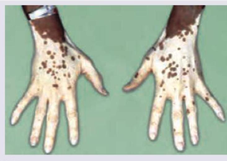 Image for question 80