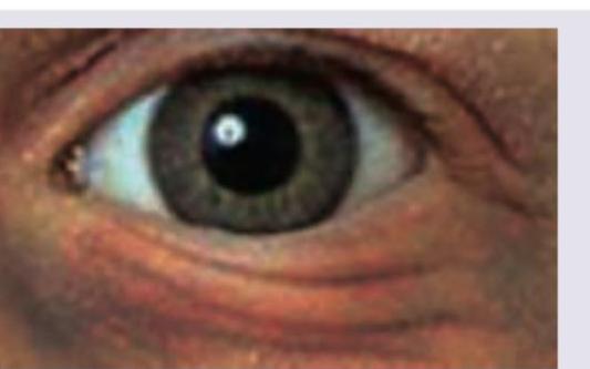 Image for question 89