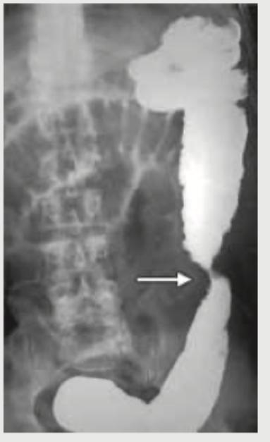 Image for question 551