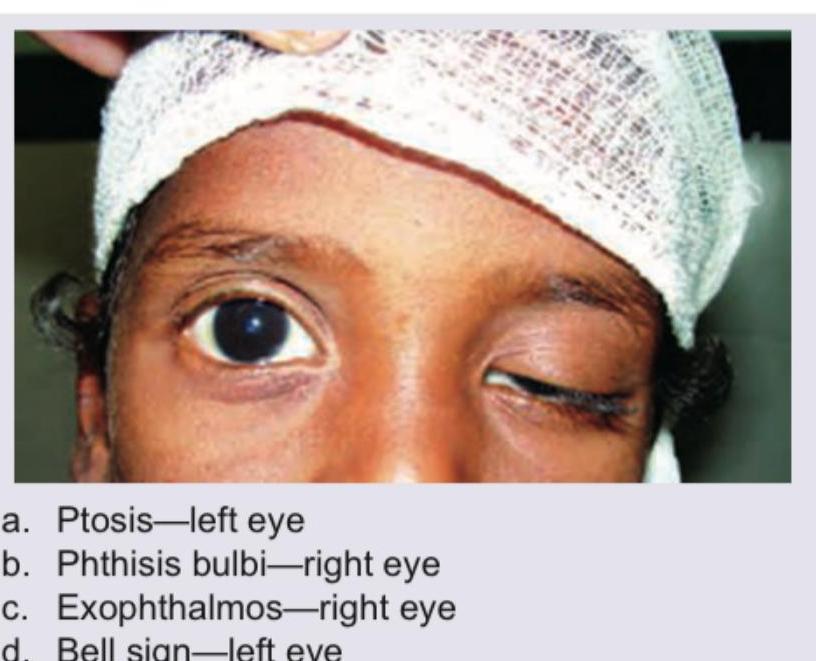 Image for question 358