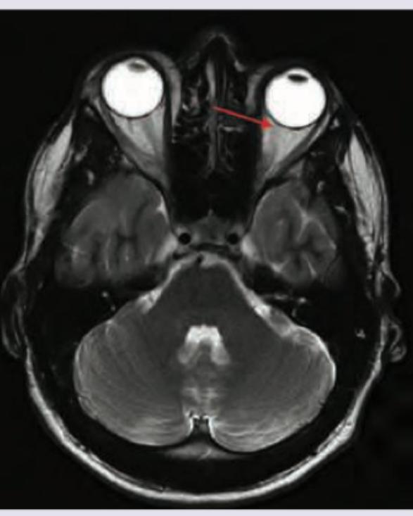 Image for question 368