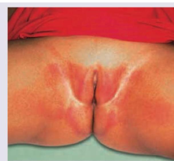 Image for question 123