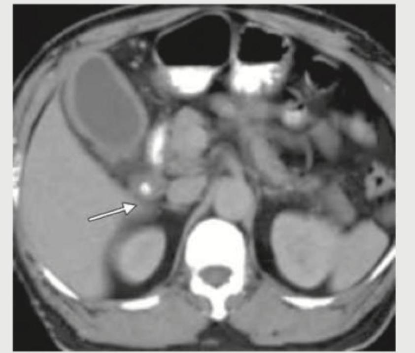 Image for question 556