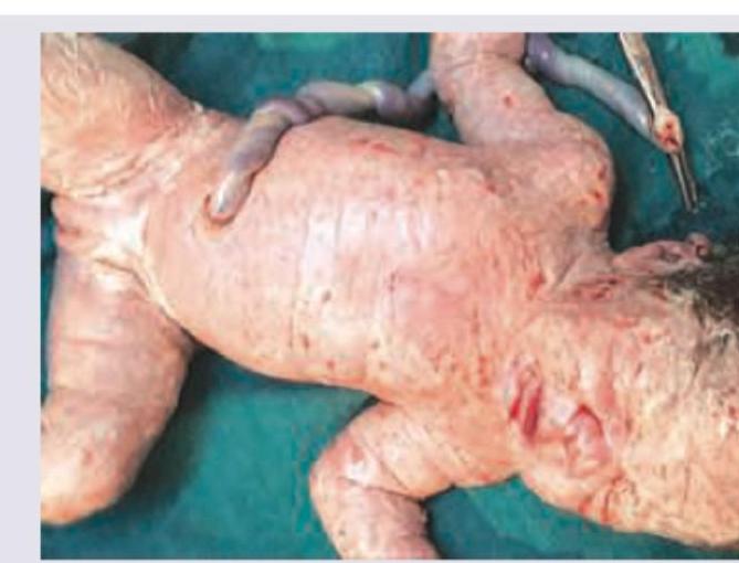 Image for question 735