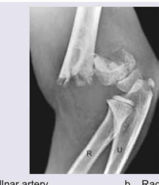 Image for question 2