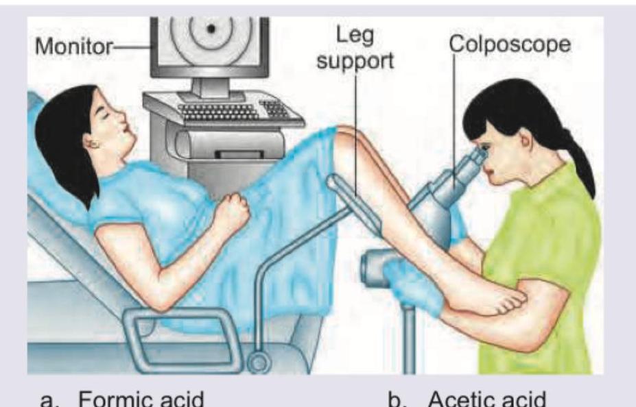 Image for question 910