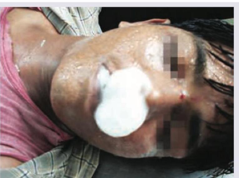 Image for question 210