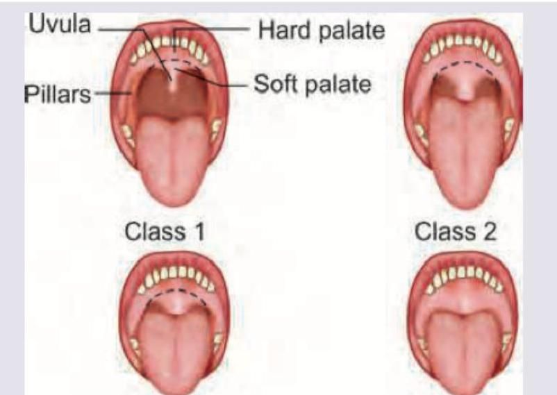 Image for question 296