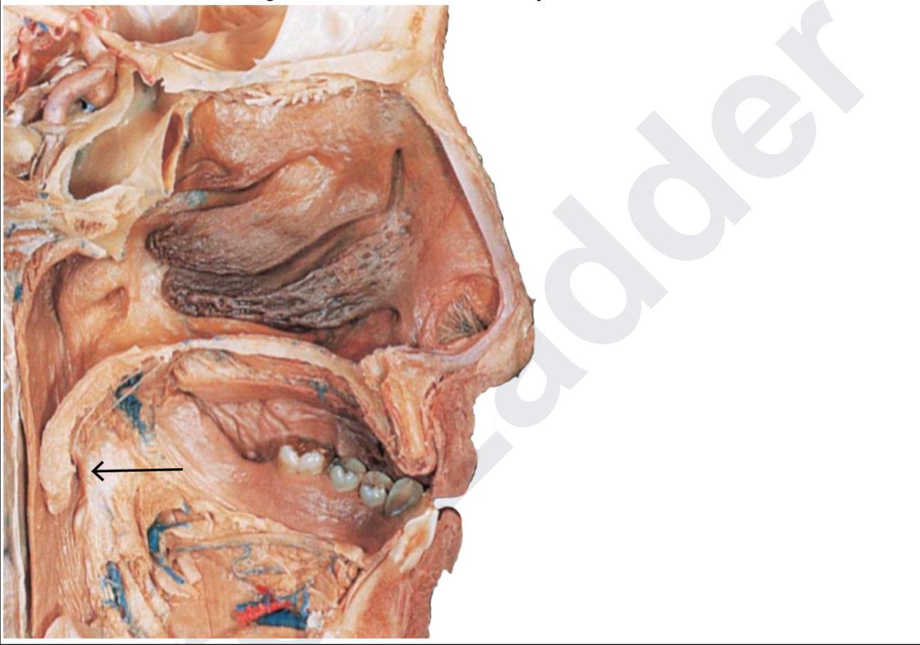 Image for question 6