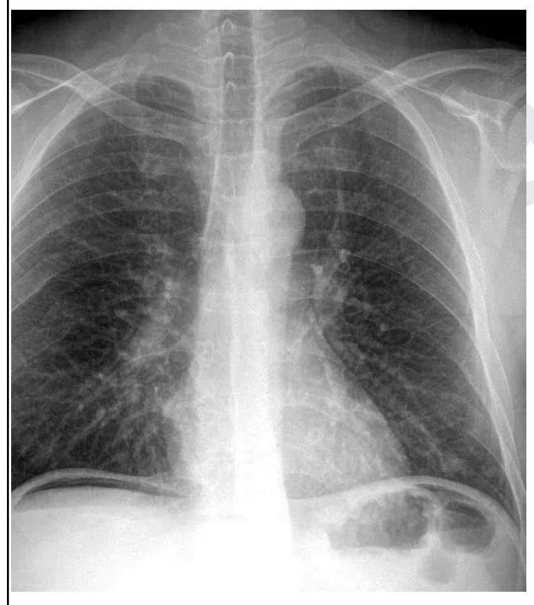 Image for question 1