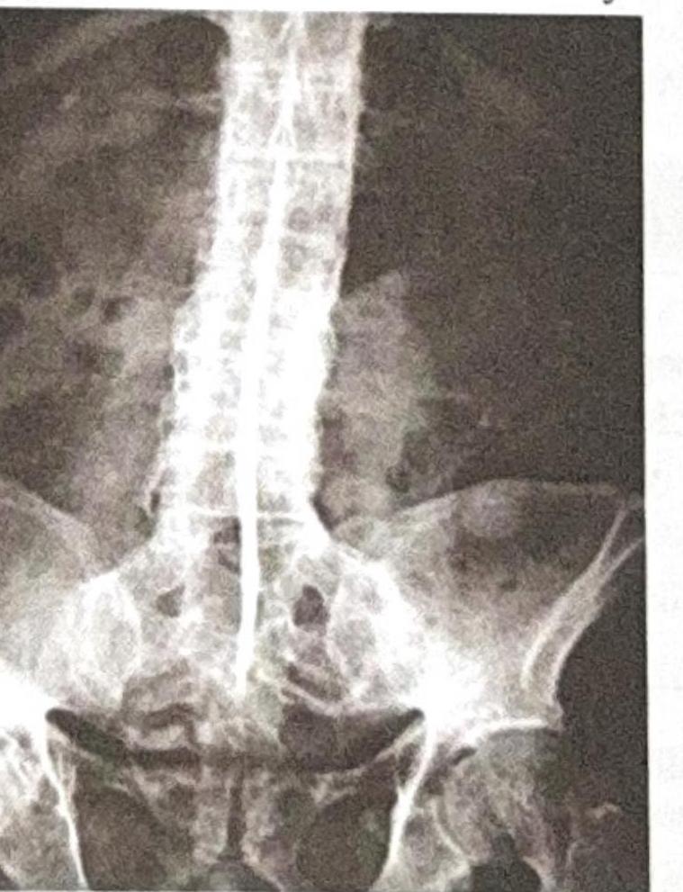 Image for question 628