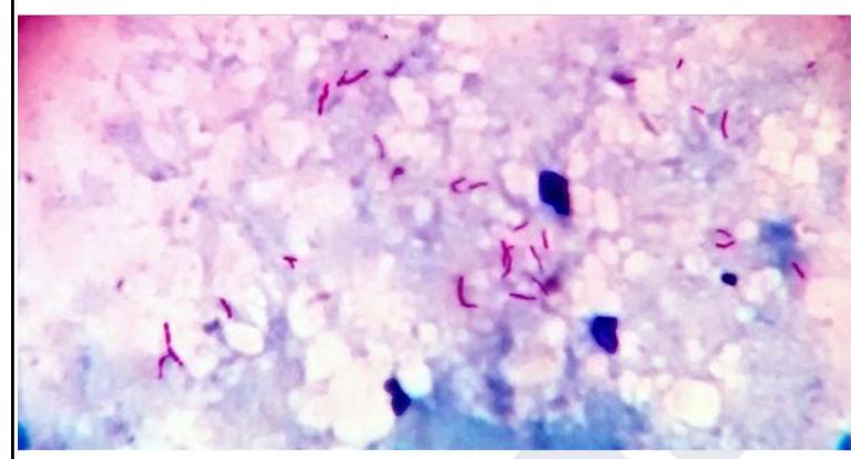 Image for question 6