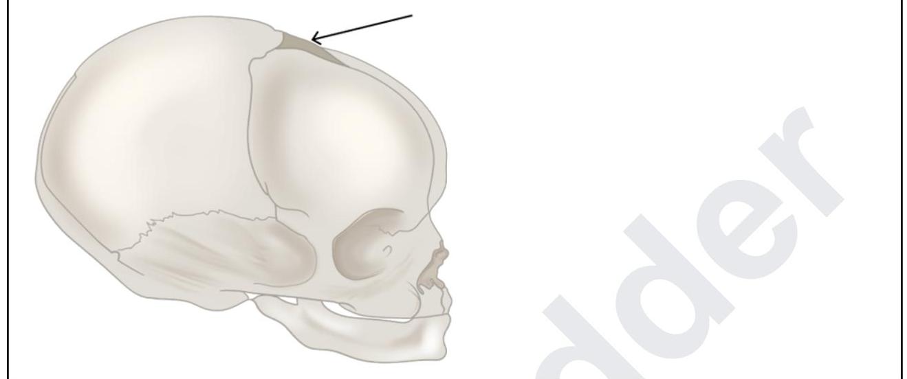 Image for question 65