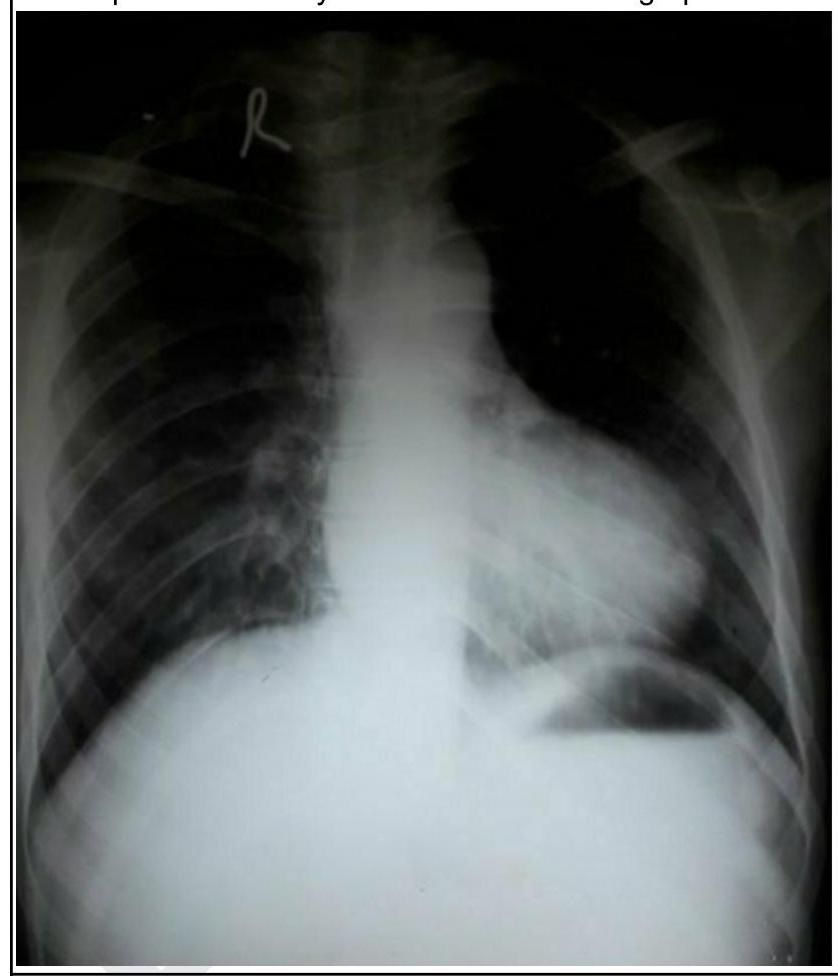 Image for question 76