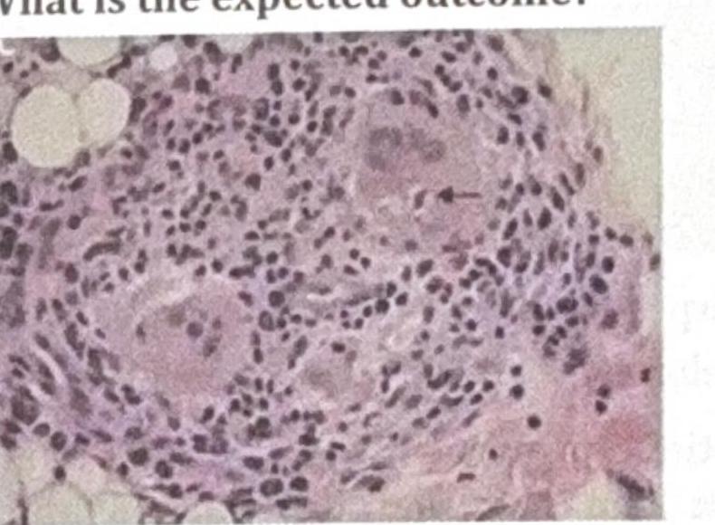 Image for question 774