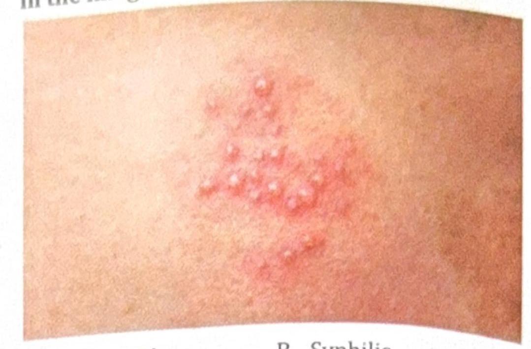 Image for question 2