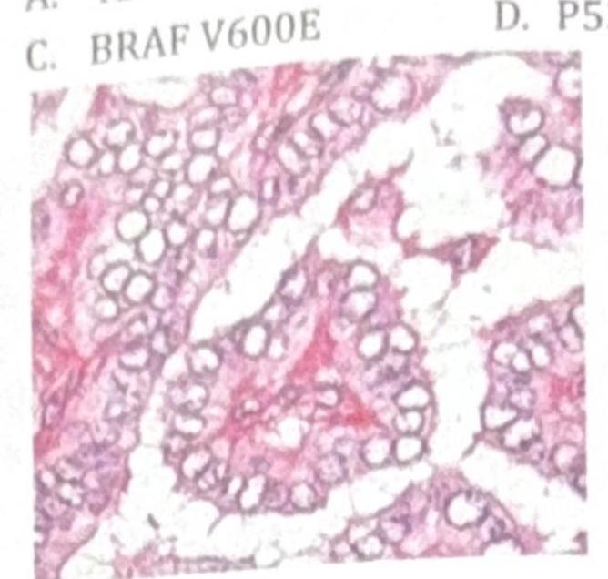 Image for question 882