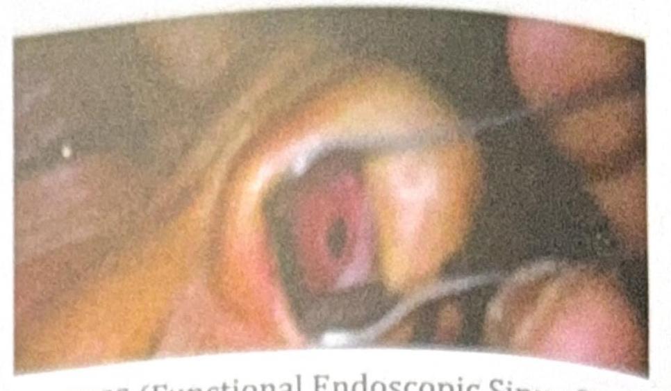 Image for question 4