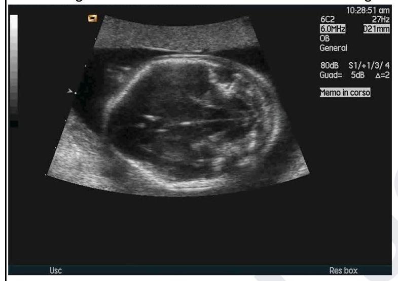 Image for question 2