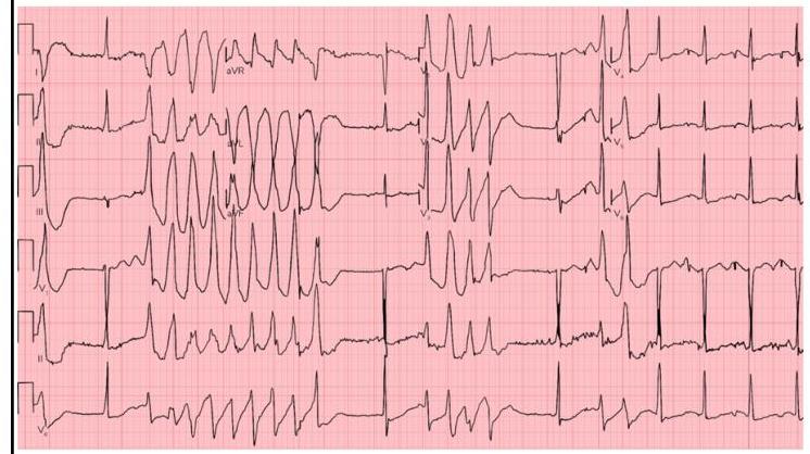 Image for question 1