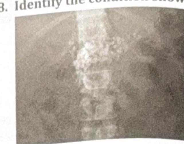 Image for question 7