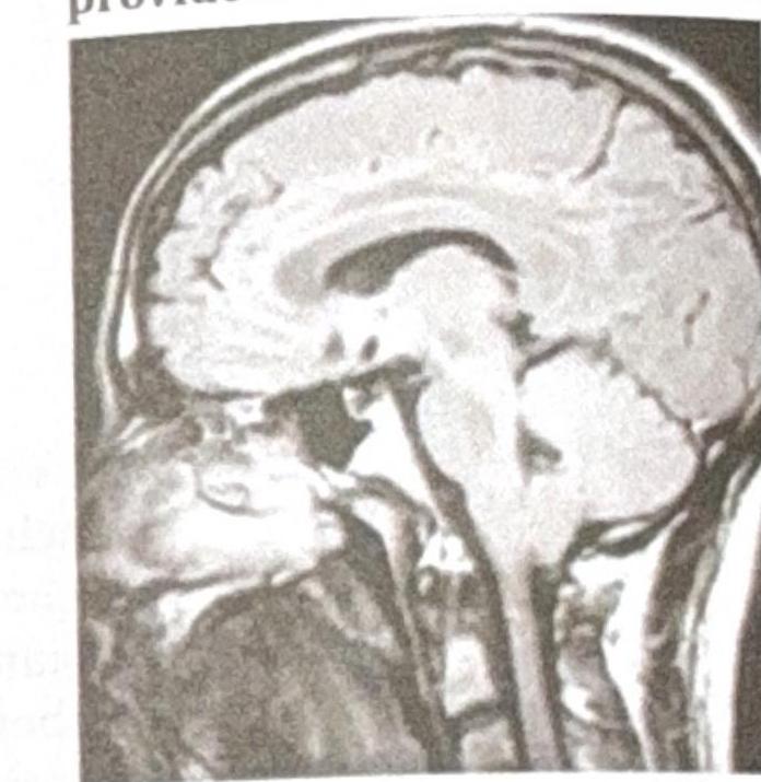 Image for question 2