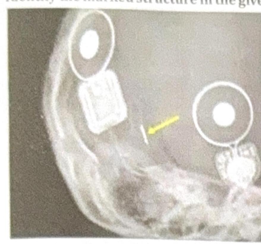 Image for question 3